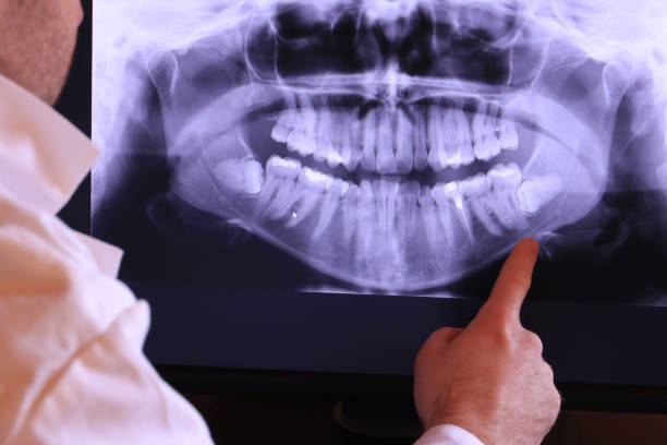 Best Emergency Denture Repair in Highland Heights, OH
